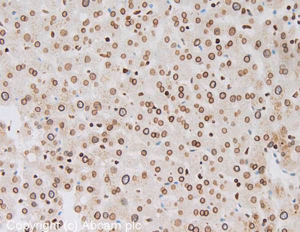 IHC image of Lamin B1 staining in human normal liver tissue.
