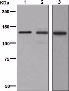 The lysate in this image is prepared by 1%SDS Hot lysis method