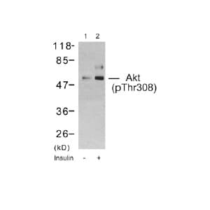 Anti-AKT (phospho T308) antibody(AB38449)