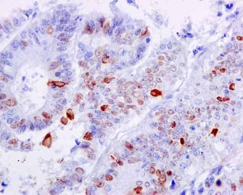 Nucleolin Phospho T76 Antibody Epr8080 2 Ab168363  Immunohistochemistry Formalin Pfa Fixed Paraffin Embedded Sections Img48609