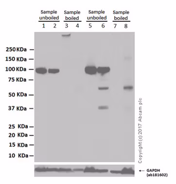 Western blot analysis of sodium-potassium ATPase in HeLa and Raw264.7 cells comparing RIPA and SDS lysis methods.