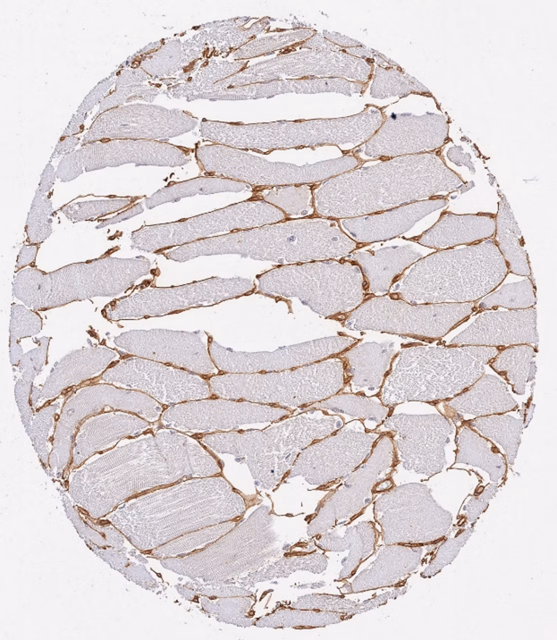Immunohistochemical analysis of formalin-fixed paraffin-embedded human skeletal muscle cells labelling Collagen IV with ab6586 at 1/15 dilution for 1 hour at 37 °C followed by a ready to use Polymer-HRP, Rabbit/Mouse Detection Kit.