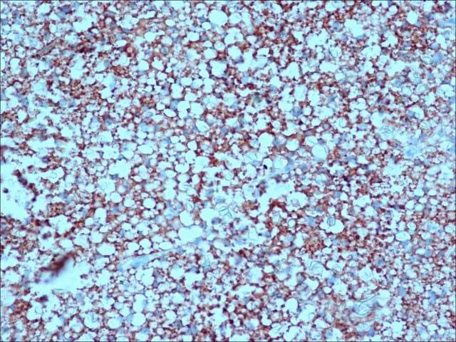 Anti-UCP1 antibody(AB10983)