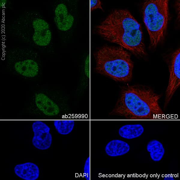 Anti-YTHDC1 antibody [EPR21821-213](AB259990)