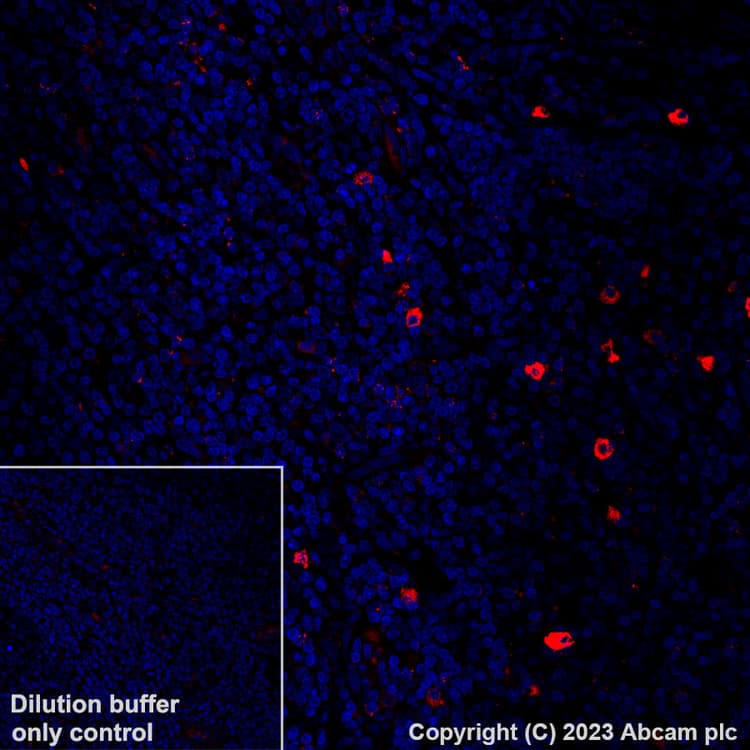 Alexa Fluor 555 Granzyme B Antibody Epr22645 206 Ab308602  Immunohistochemistry Formalin Pfa Fixed Paraffin Embedded Sections Img409017