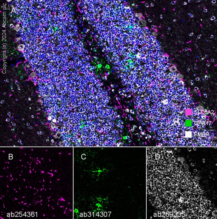 Anti-FMRP antibody [EPR23852-90] - BSA and Azide free(AB277489)