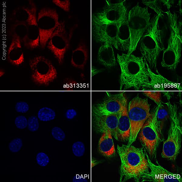 Alexa Fluor® 594 Anti-Collagen I antibody [EPR24331-53](AB313351)