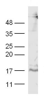 Anti-PDGF AA antibody(AB216619)