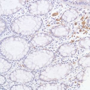 Gpnmb Antibody Sp299 Bsa And Azide Free Ab272016  Immunohistochemistry Formalin Pfa Fixed Paraffin Embedded Sections Img45995