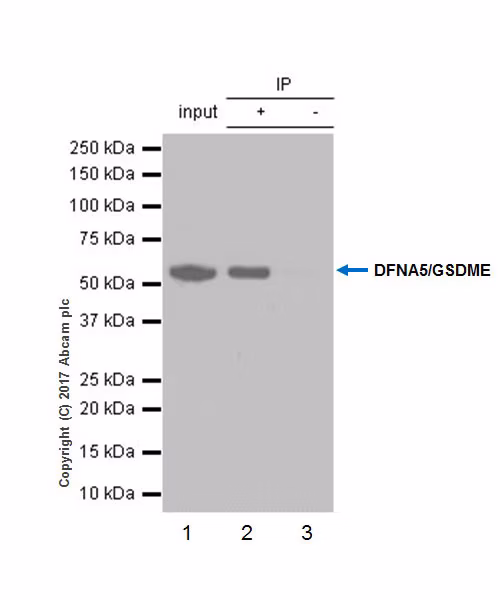 Western blot analysis of DFNA5/GSDME immunoprecipitation in EMT6 cells.