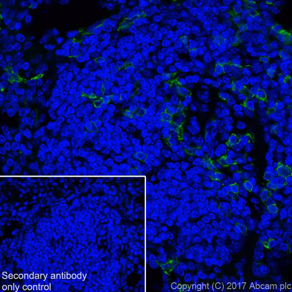 Immunohistochemical staining of mouse spleen tissue for CD8 alpha using ab217344.