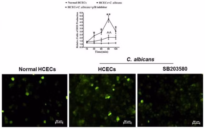 Fluorescence microscopy of cellular ROS assay kit (ab113851) showing p38 MAPK pathway in oxidative injury of HCECs by C. albicans