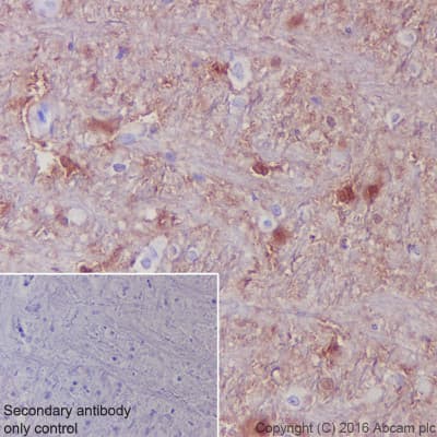 Anti-S100 alpha antibody [EPR5250](AB133519)