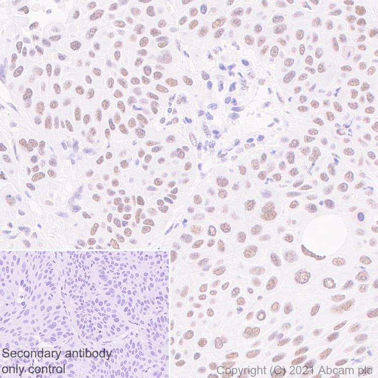 Anti-BAP1 antibody [EPR22826-65](ab255611)