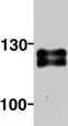Western blot analysis using Ctip2 antibody (ab18465) on Jurkat cell nuclear extract, immunoprecipitated with anti-Sir2 antibody.