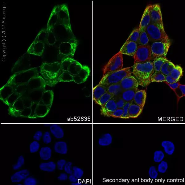 Anti-Cytokeratin 5 antibody [EP1601Y] - Cytoskeleton Marker(AB52635)