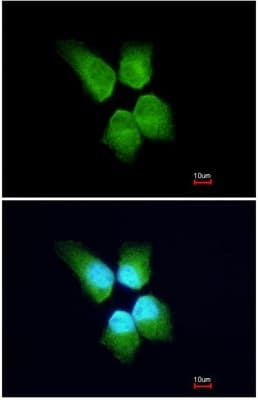Sld5 Antibody Ab101346  Immunocytochemistry Immunofluorescence Img68600