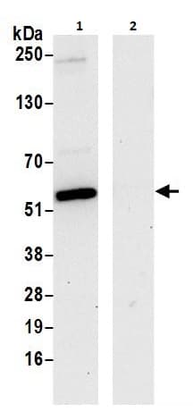 Ppp2r2b Antibody Ab264160  Immunoprecipitation Img66162