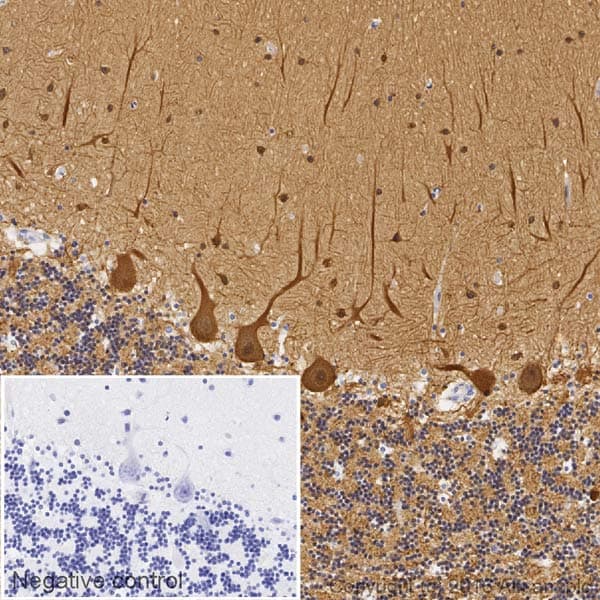 Biotin Beta Iii Tubulin Antibody Ep1569y Neuronal Marker Ab195903  Immunohistochemistry Formalin Pfa Fixed Paraffin Embedded Sections Img52464