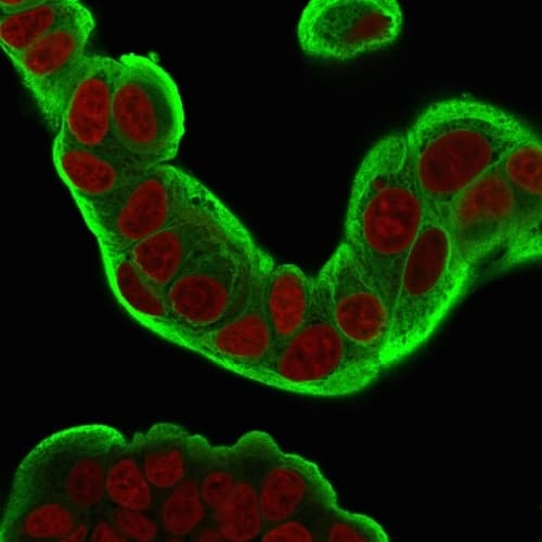 Hsp27 Antibody Cptc Hspb1 2 Ab268073  Immunocytochemistry Immunofluorescence Img19973