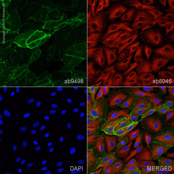 Immunocytochemistry using anti-CD31 antibody [JC/70A] (ab9498) staining CD31 in HUVEC cells for vascular research