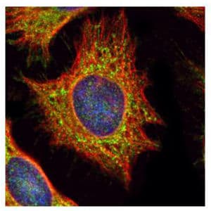 Anti-XYLT2 antibody(AB155193)