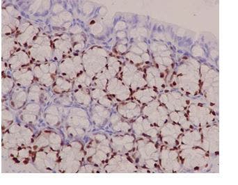 Immunohistochemistry analysis of paraffin-embedded mouse colon tissue labeling SOX9 with ab185966 at 1/1000 dilution.