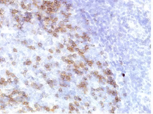PD1 protein expression in human tonsil tissue
