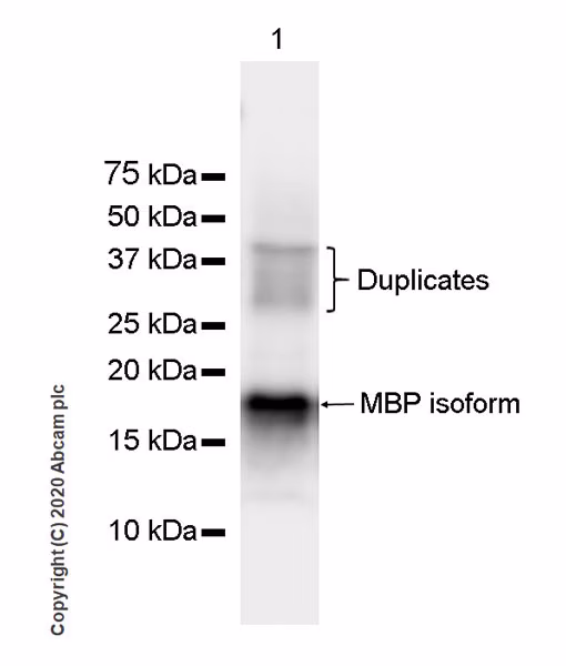 Western blot analysis of human cerebellum tissue lysate showing a band at 18.5 kDa, consistent with the predicted size of Myelin Basic Protein.