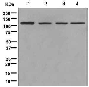 Anti-KDS antibody [EPR4947(2)] - BSA and Azide free(AB248958)