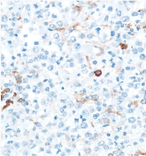 Cd16 Antibody Sp175 Ab183354  Immunohistochemistry Formalin Pfa Fixed Paraffin Embedded Sections Img30012