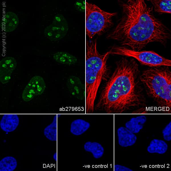 Anti-Ki67 antibody [B56](AB279653)