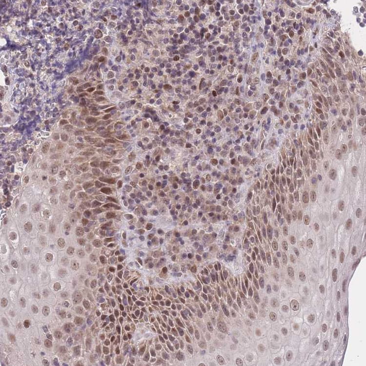 Anti-PUS10 antibody(AB185078)