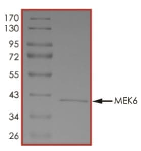 Recombinant Human MEK6 protein (His tag)(AB268756)