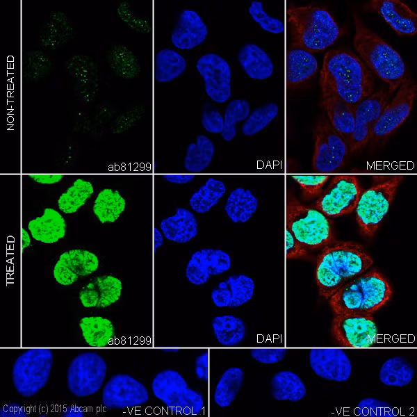 HeLa cells stained for Histone H2A.X (phospho S139), tubulin, and nuclei.