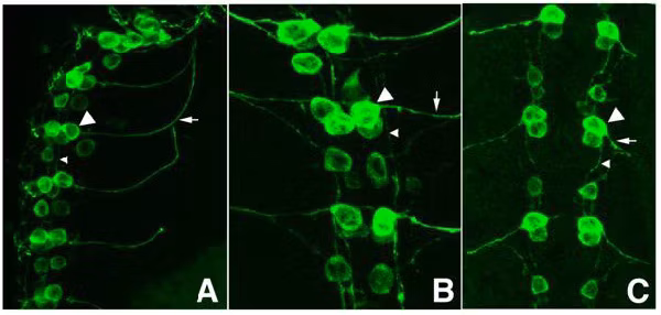IHC - Wholemount - Anti-GFP antibody (ab6673) Panel A: shows a lateral view (ventral left). Panels B and C: shows ventral views of whole mount embryos at 63x magnification (plus 2x digital zoom).