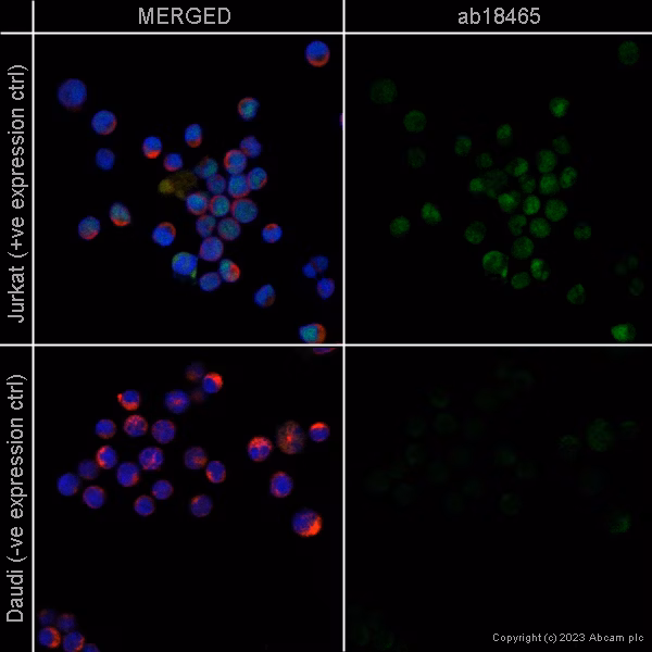 Immunofluorescence staining of Ctip2 using ab18465 in Jurkat cells (+ve expression control, top panel) and Daudi cells (-ve expression control, bottom panel).