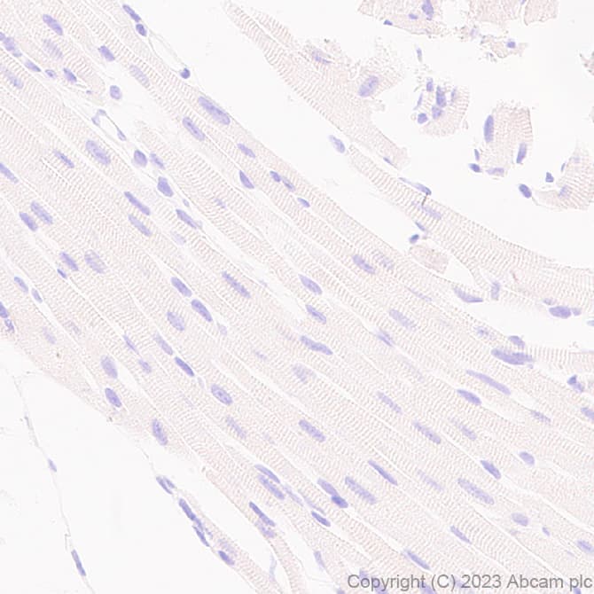 Anti-FOXF1 antibody [EPR27368-79](AB308633)
