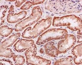Ndufb11 Antibody Epr15252 Bsa And Azide Free Ab250690  Immunohistochemistry Formalin Pfa Fixed Paraffin Embedded Sections Img24146