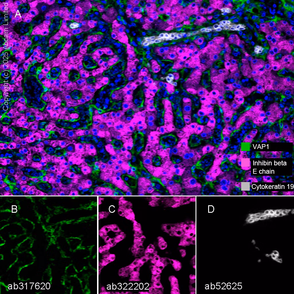 Cytokeratin 19 Antibody Ep1580y Cytoskeleton Marker Ab52625 Multiplex Immunohistochemistry Img447032