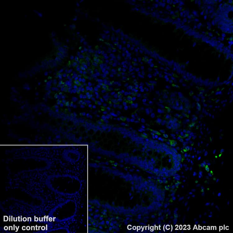 Alexa Fluor® 488 Anti-Mannose Receptor antibody [EPR22489-7](AB313398)