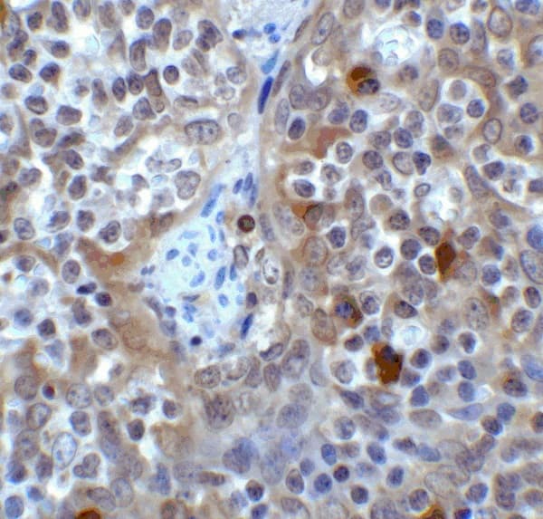 Anti-VISTA antibody(AB254581)