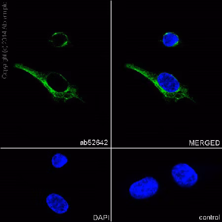 Immunofluorescence image of human melanoma cells stained for S100 beta protein (green) and nuclei (blue). Negative control is also shown.
