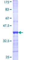 Ab152296  Sds Page Img35091