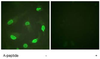 P53 Acetyl K381 Antibody Ab61241  Immunocytochemistry Immunofluorescence Img93212
