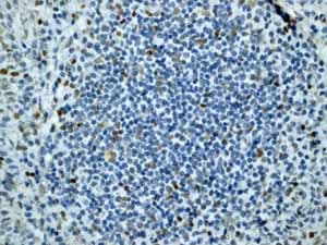 Anti-ATM (phospho S1981) antibody [EP1890Y](AB81292)