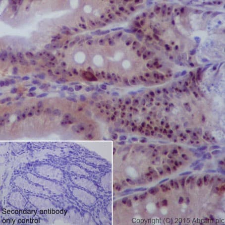 Dcaf13 Antibody Epr18723 Bsa And Azide Free Ab240337  Immunohistochemistry Formalin Pfa Fixed Paraffin Embedded Sections Img99239