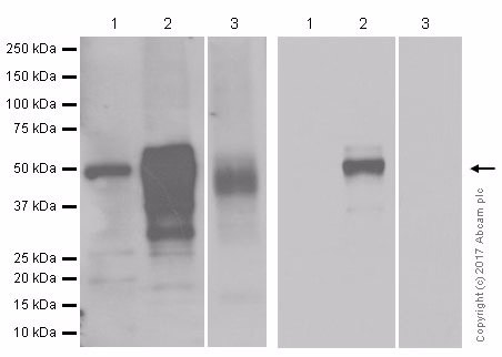 Western blot - Anti-Wilms Tumor Protein antibody [CAN-R9(IHC)-56-2] (ab89901) at 1/500 dilution Lane 1: Human testis whole cell lysate. at 15 µg Lane 2: K562 (Human T cell leukemia T lymphocyte) whole cell lysates at 4 µg Lane 3: Mouse testis whole cell lysates at 15 µg