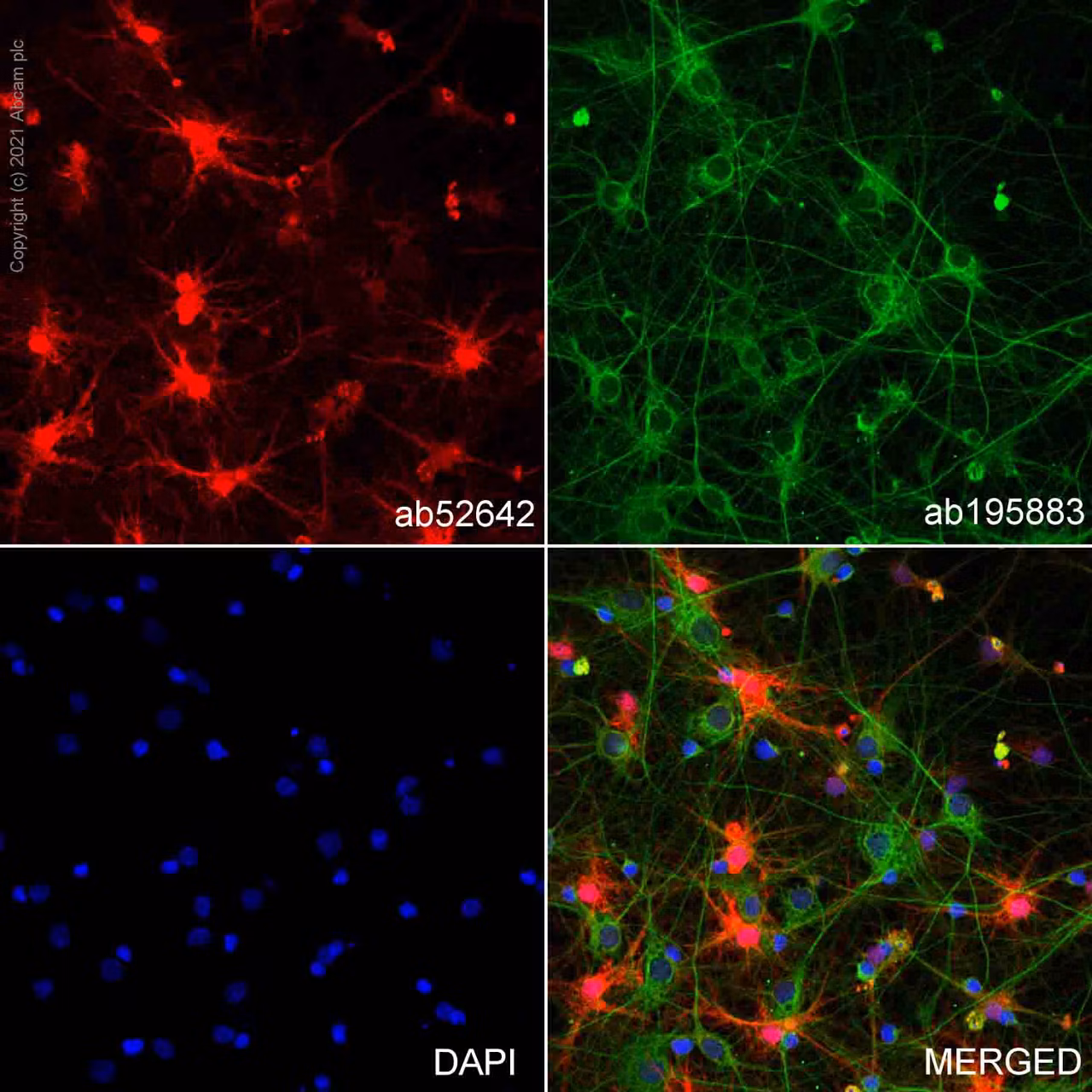 Confocal microscopy image of primary rat neurons/glia stained for S100 beta (red), alpha Tubulin (green), and DNA (blue).