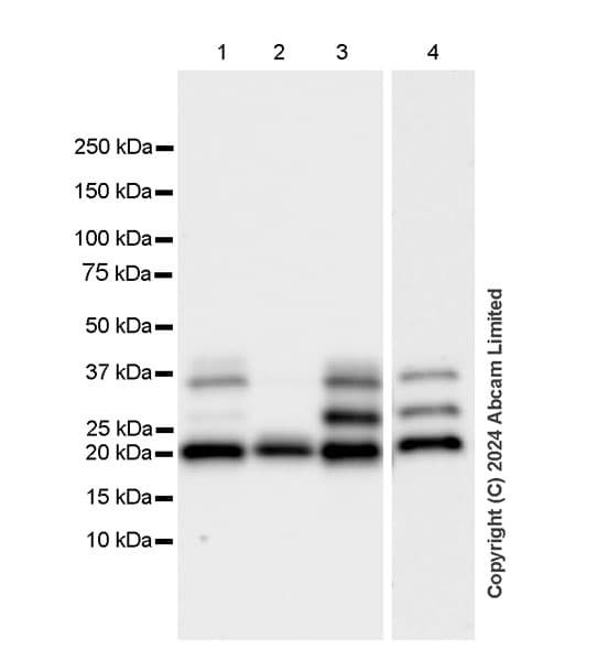 Anti-Cathepsin L/MEP antibody [EPR29413-573](AB321872)